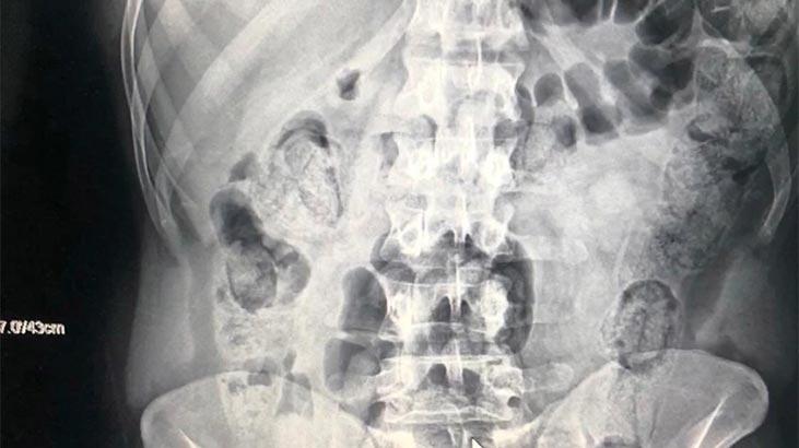 Yolcu kılığına girdiler! Hepsi midelerinden çıktı Yolcu kılığına girdiler! Hepsi midelerinden çıktı