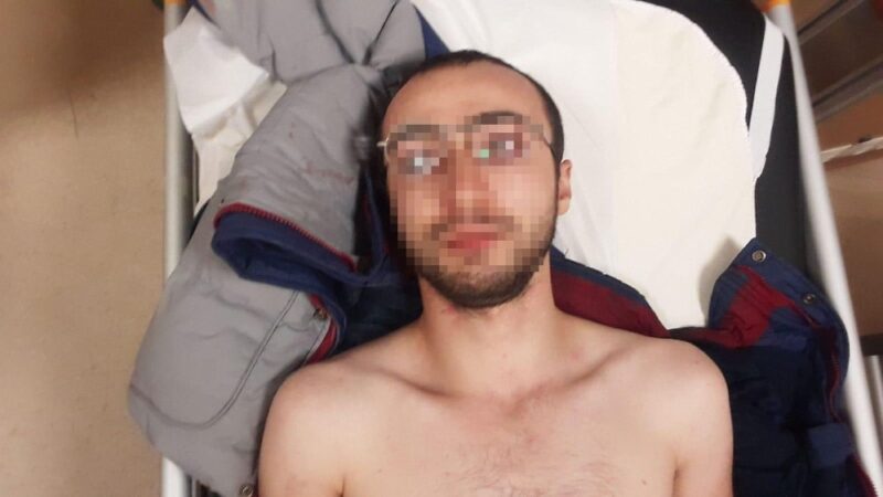 Bursa’nın İznik ilçesinde ağabeyi tarafından bıçakla yaralanan 19 yaşındaki genç,