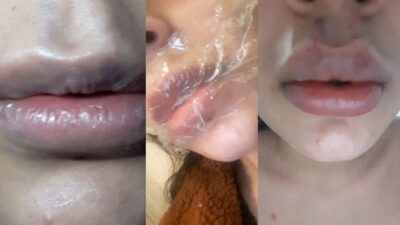 Dudağını kaybedebilir! Yarım saat sonra beni odaya çağırdılar…