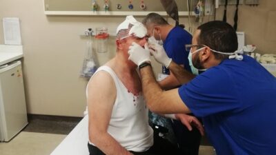 Gelecek Partisi Genel Başkan Yardımcısı Selçuk Özdağ’a saldırı