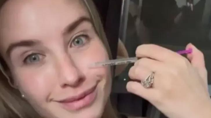 Yaşlanmayı önlemek için yüzüne anne sütü enjekte ediyor Yaşlanmayı önlemek için yüzüne anne sütü enjekte ediyor