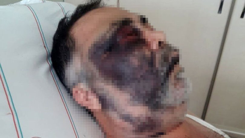 Darp edilen engelli adamdan acı haber Darp edilen engelli adamdan acı haber