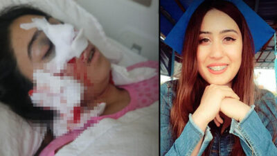 Burun estetiği ameliyatı sonrası ölen Leyla’nın ses kaydı ortaya çıktı: Ağzımdan, burnumdan kan geliyor