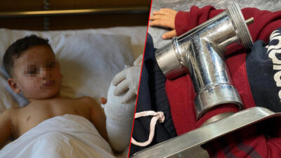 3 yaşındaki çocuk elini kıyma makinesine kaptırdı