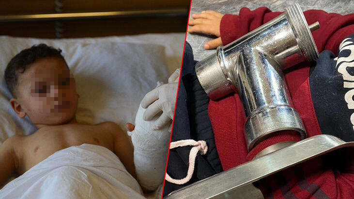 3 yaşındaki çocuk elini kıyma makinesine kaptırdı 3 yaşındaki çocuk elini kıyma makinesine kaptırdı