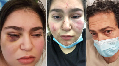 Almanya’da skandal! Türk aileyi önce dövdüler, sonra ölümle tehdit ettiler