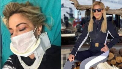 Burcu Şendir’in korkutan kazası! Kayak yaparken…