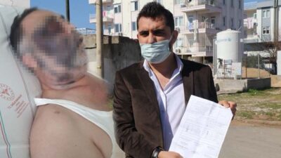 Park yeri kavgasında engelli vatandaşa öldüresiye dayak