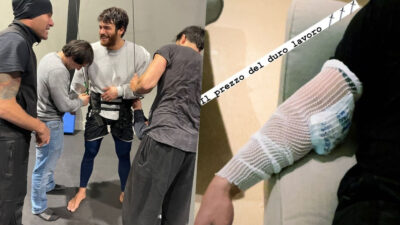 Ünlü oyuncu kaza geçirdi