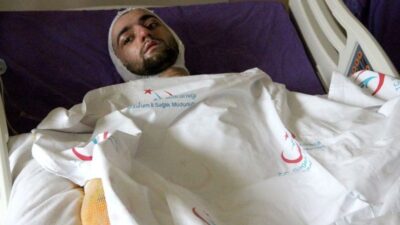 Üniversite öğrencisi sobaya benzin döktü, sonrası feci!