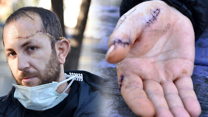 Damadını bu hale getirdi! Kayınpedere ömür boyu hapis istendi Damadını bu hale getirdi! Kayınpedere ömür boyu hapis istendi