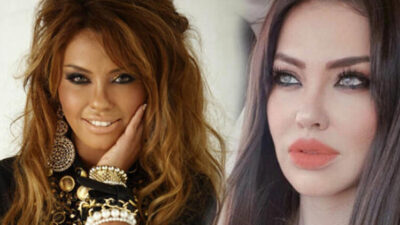 Bu sefer de büyük dudaklarını küçülttü