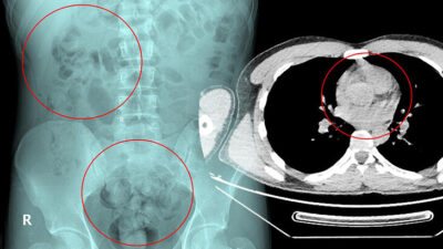 Otogarda rahatsızlanınca ortaya çıktı! Neredeyse 1 kilo…