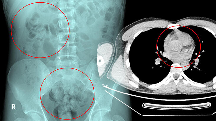 Otogarda rahatsızlanınca ortaya çıktı! Neredeyse 1 kilo…