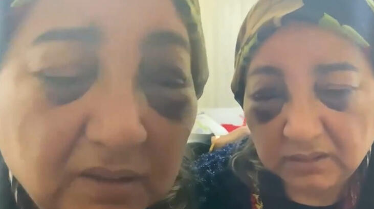 Eşini 2 gün boyunca dövüp aç bırakan koca tutuklandı!