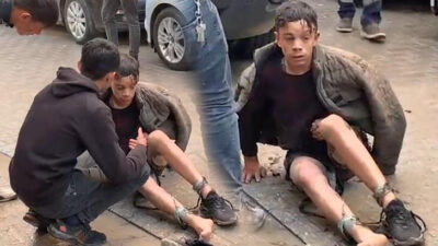 Tinerle soba tutuşturmak isteyen genç, kendini yaktı!