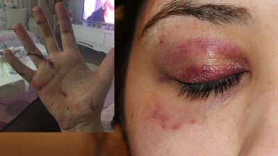Genç kadını darp etti, sabah ‘Pide yaptırayım mı?’ diye mesaj attı