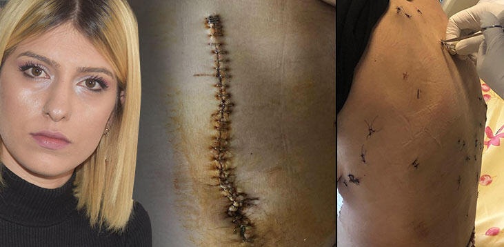 ‘Bu son yemeğin güzel ye’ dedi ve dehşeti yaşattı!