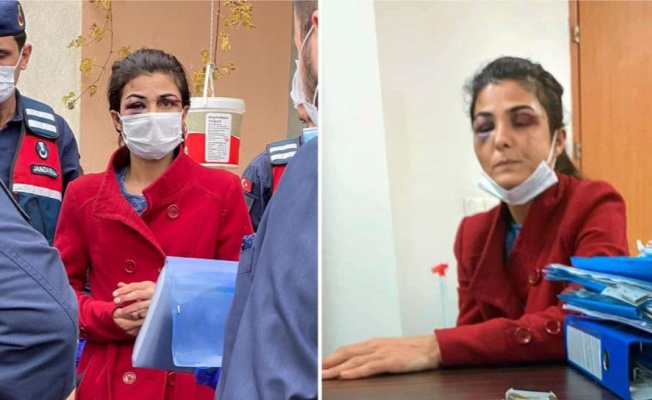 İfadesi kan dondurdu! ‘Rüyasında onu terk ettiğimi görür, döverdi’