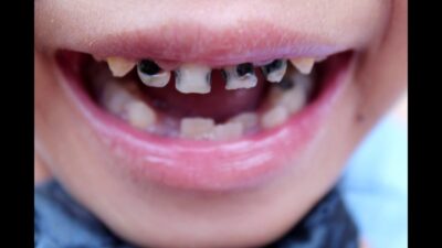 Çürüklerle savaşacak güçte… Her gün içmenin…