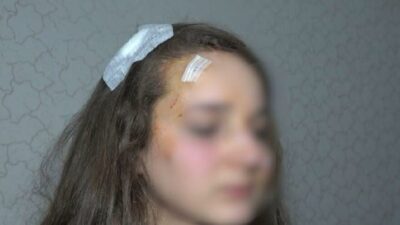 Bursa’da genç kadın sokak ortasında dehşeti yaşadı