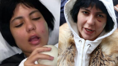 Bursa’da darp edilen Bahar Candan’a ikinci şok! Paramparça oldu