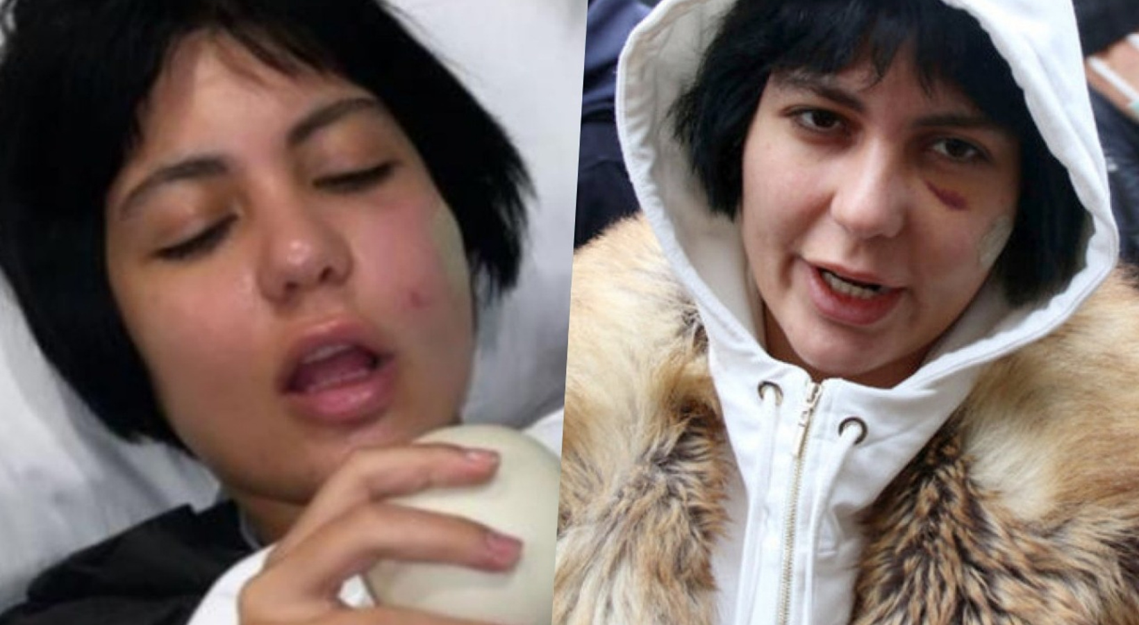 Bursa’da darp edilen Bahar Candan’a ikinci şok! Paramparça oldu