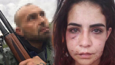 Eski sevgilisinin darbettiği Beyza: Ölmek istemiyorum