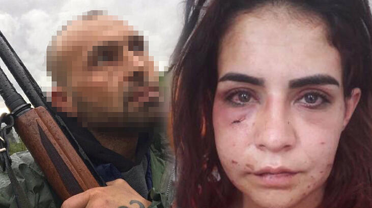 Eski sevgilisinin darbettiği Beyza: Ölmek istemiyorum