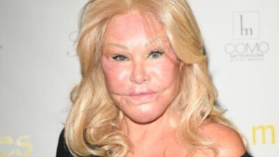 Yaptırdığı estetik ameliyatlar sonu oldu!