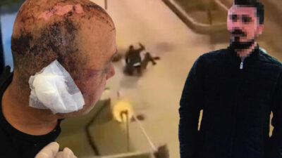 Telsizle dövülen polis memuru: Gözlerimi hastanede açtım