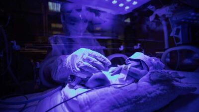 İlk kez görüntülendi! Türkiye’nin çocuk koronavirüs hastaları…