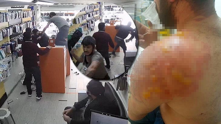 40 dakika dövüp, vücuduna kaynar su döktüler