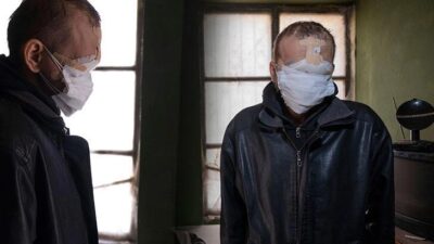 Cilt kanserinden yüzünü kaybetti! ‘Kızımı öpmeyi çok özledim’