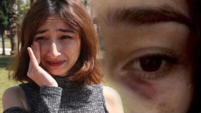 Şiddet gören Gülsüm Demiray: Ölmek istemiyorum