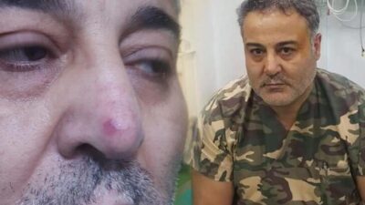 Doktor, hasta yakınının yumruklu saldırısında yaralandı