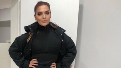 Demet Akalın, yüzünün yandığı bir pozunu paylaştı