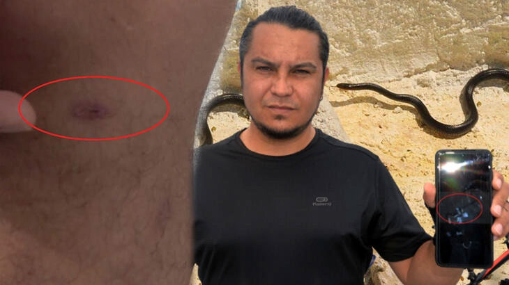 Bisiklet kullanırken yılan ısırdı! Zehrini boşaltmadığı için…