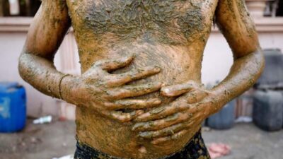 Koronaya karşı inek dışkısı!