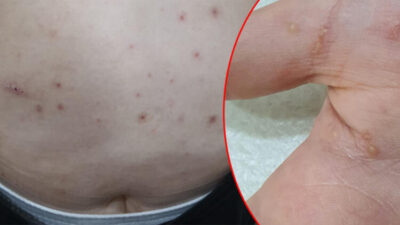 Korkulan tehlike ortaya çıktı! Ciddiye alınmazsa geç kalınıyor…