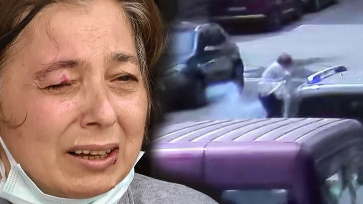 Yoldaki kadının gözüne maytap isabet etti!