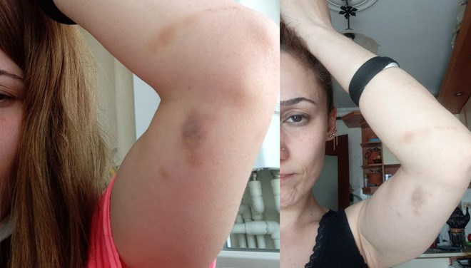 İzmir’de patronu tarafından kızlarının gözleri önünde dövüldü iddiası