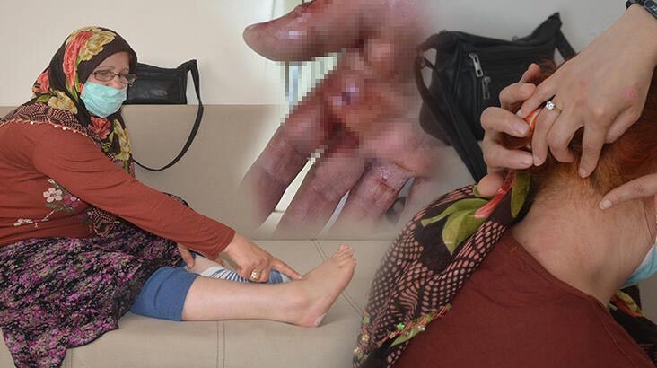 Engelli kadın dehşeti anlattı! Bana çok işkence yaptılar