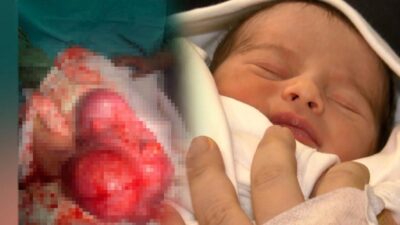 Ünlü oyuncunun bebeği savaşı kazandı; doktorların ise ”mucize” bebeği…