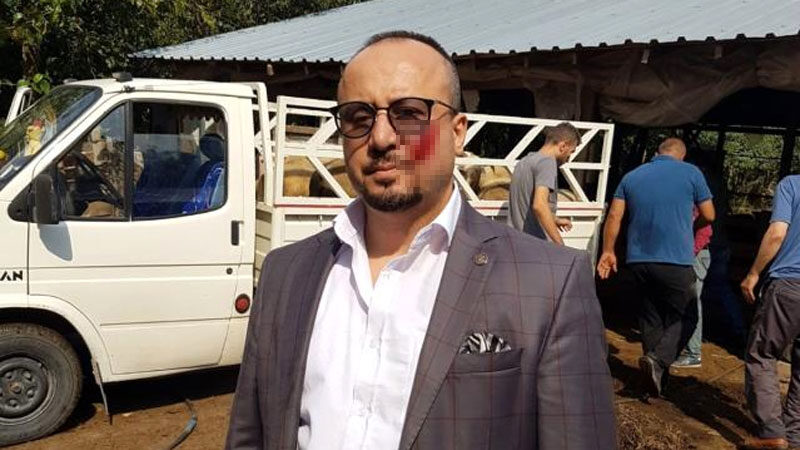 Bursa’da haciz sırasında avukatın yanağını ısırdı! İşte cezası… Bursa’nın Orhaneli ilçesinde haciz işlemi sırasında Av. Cüneyt Bülent Şeker’i