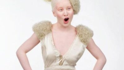 Bebekken terkedilmişti! Şimdi herkes peşinden koşuyor…