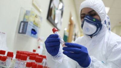 Salgında son durum! İşte günlük vaka sayısı…