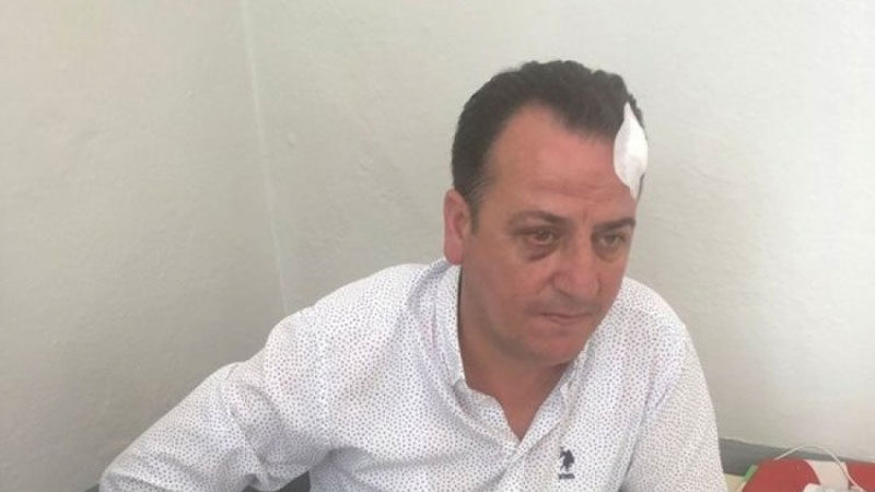 Bursa'da belediye başkan yardımcısının saldırısına uğrayıp darp edildiğini iddia eden