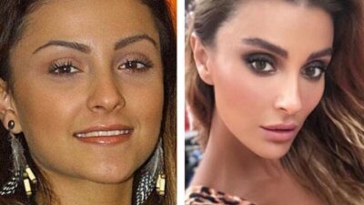 Estetik ameliyat oldu! ‘İlk’ dedi ama kimse inanmadı