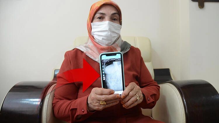 Şoke eden gerçek ameliyattan 2 ay sonra ortaya çıktı